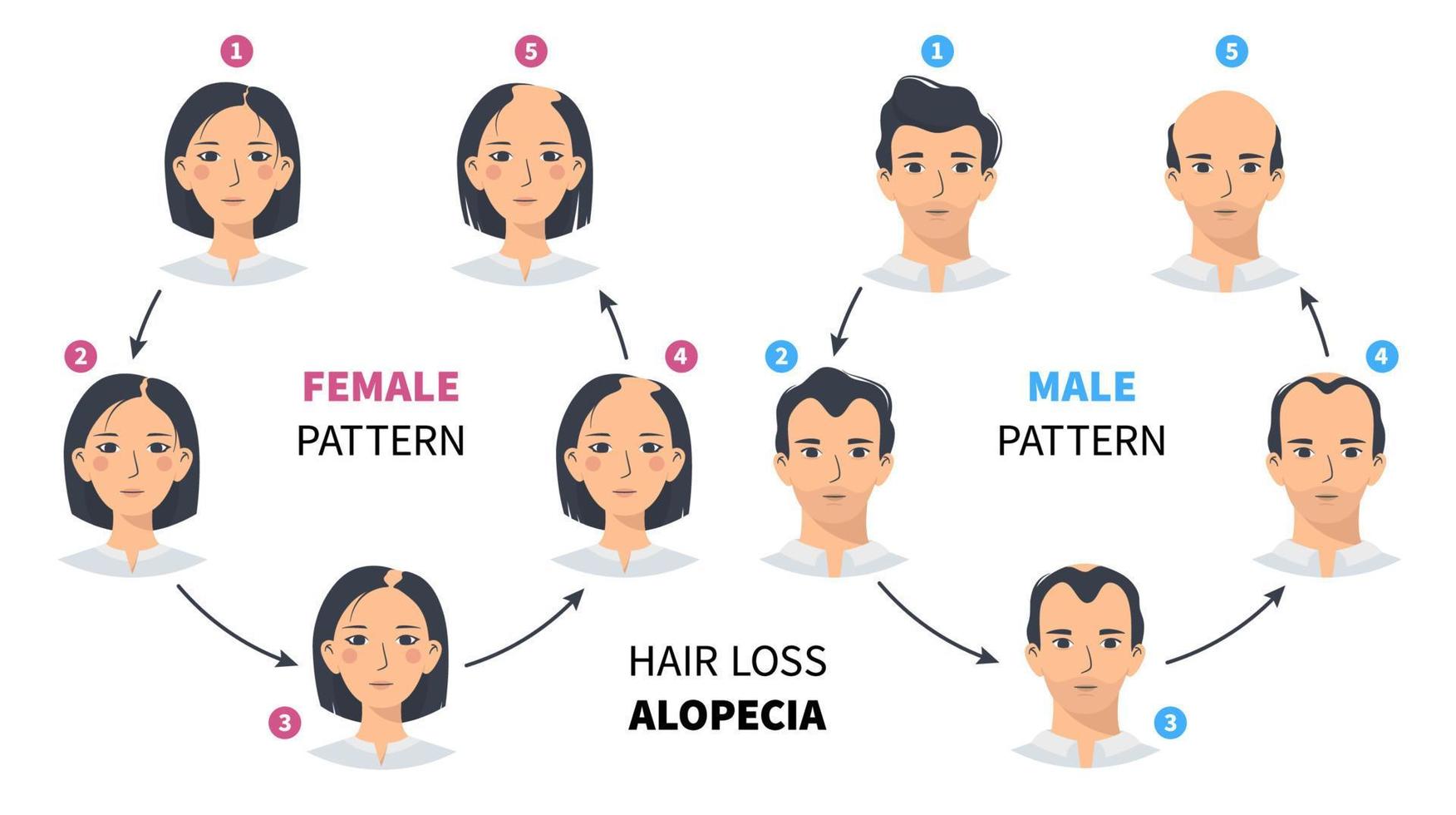Alopecia en hombres y mujeres